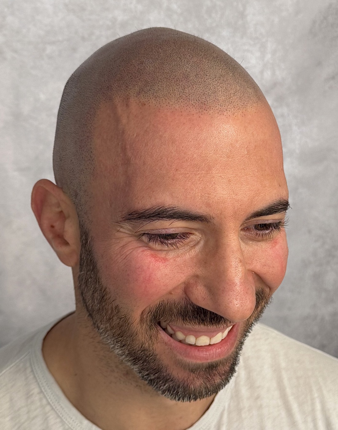 SMP after — real client result