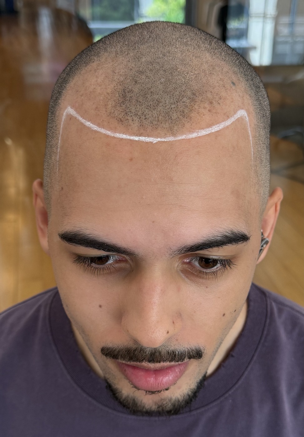 SMP before — real client result