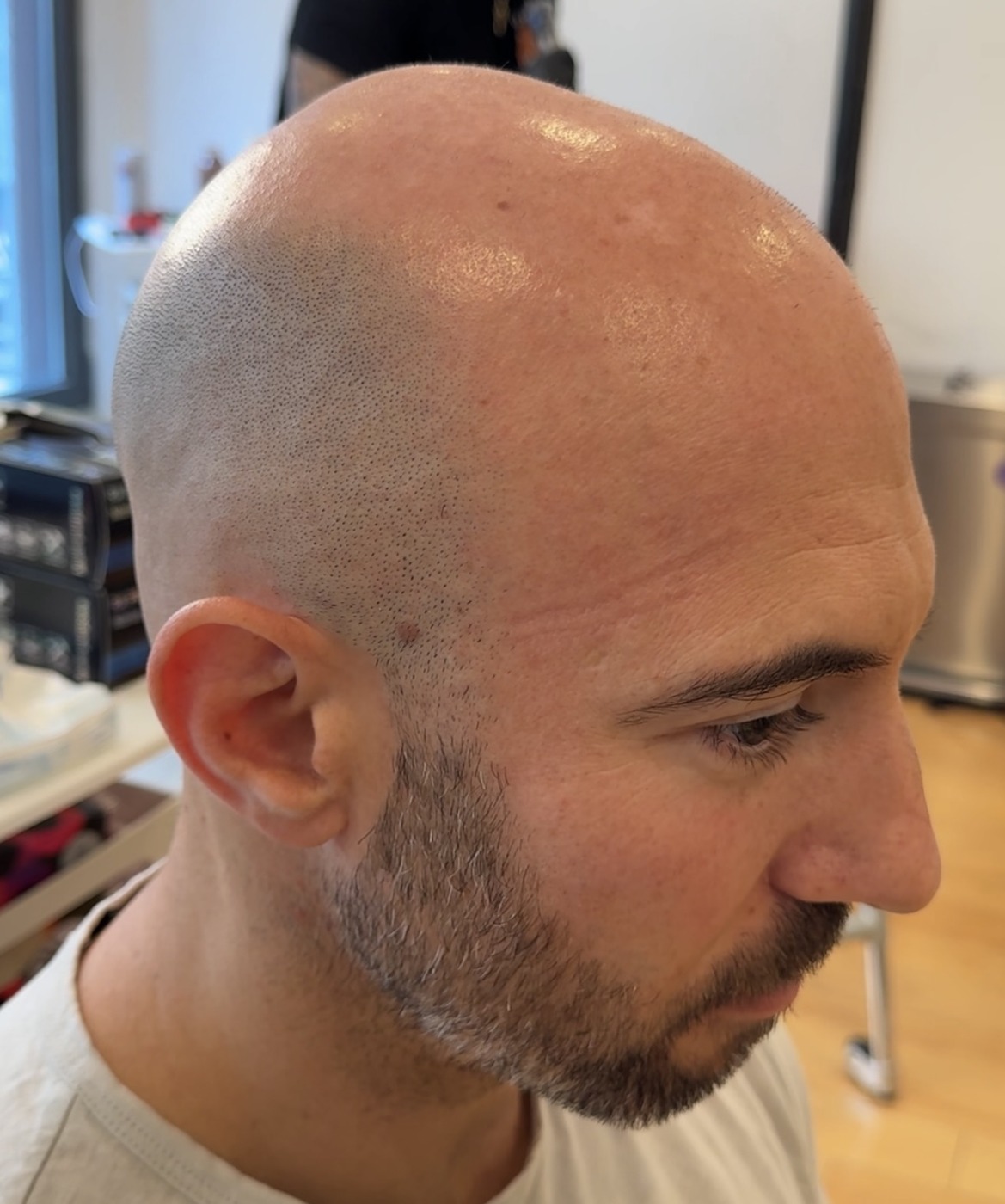 SMP before — real client result